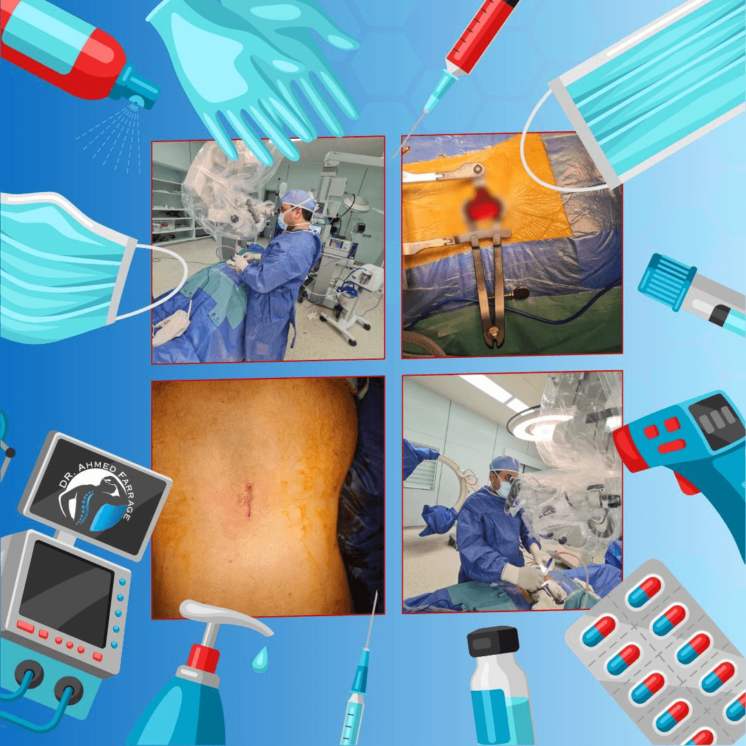 الجراحه الميكروسكوبيه